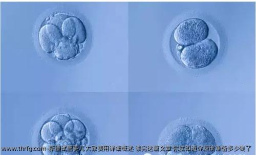 新疆试管婴儿大致费用详细概述 读完这篇文章 你就知道你应该准备多少钱了