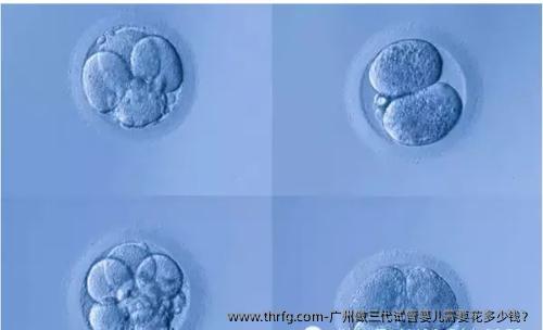 广州做三代试管婴儿需要花多少钱？