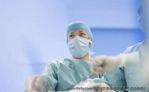 B超可以查出卵泡里是不是空的吗?