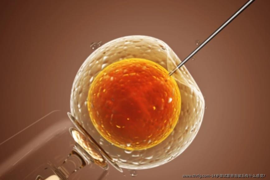 34岁做试管卵泡破后有什么感觉?