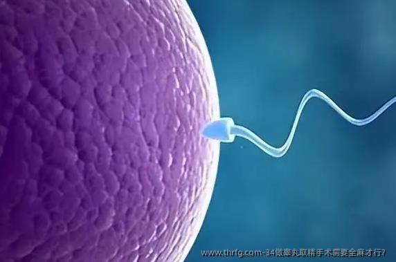 34做睾丸取精手术需要全麻才行?