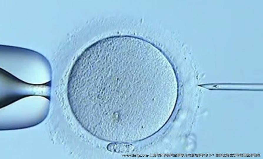 上海市同济医院试管婴儿的成功率有多少?影响试管成功率的因素有哪些