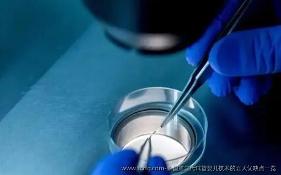 泰国第三代试管婴儿技术的五大优缺点一览