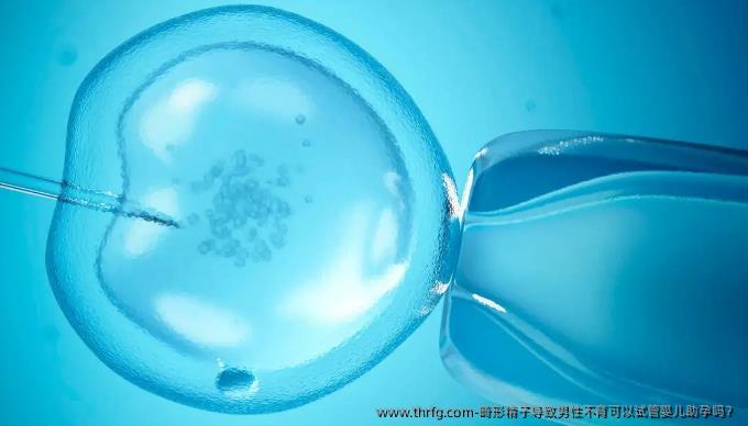 畸形精子导致男性不育可以试管婴儿助孕吗?
