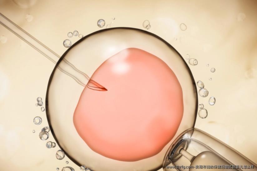 贵阳市妇幼保健院做试管婴儿怎么样