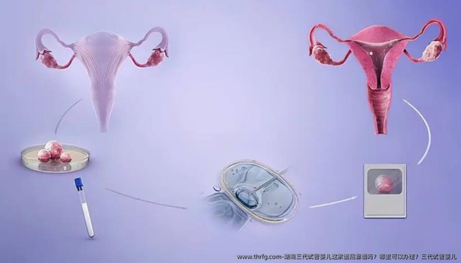 湖南三代试管婴儿这家医院靠谱吗？哪里可以办理？三代试管婴儿