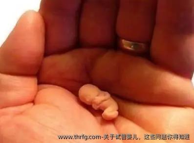 关于试管婴儿，这些问题你得知道