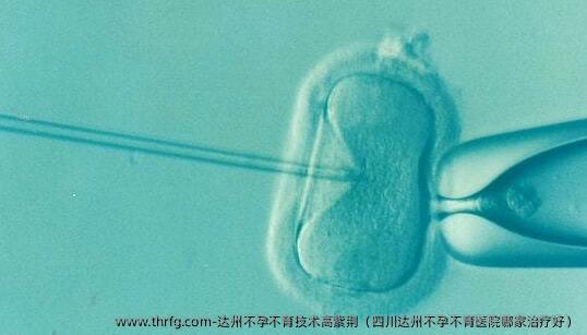 达州不孕不育技术高紫荆（四川达州不孕不育医院哪家治疗好）