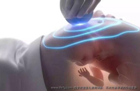 西安试管婴儿费用详解：不同方案带来的价格差异 
