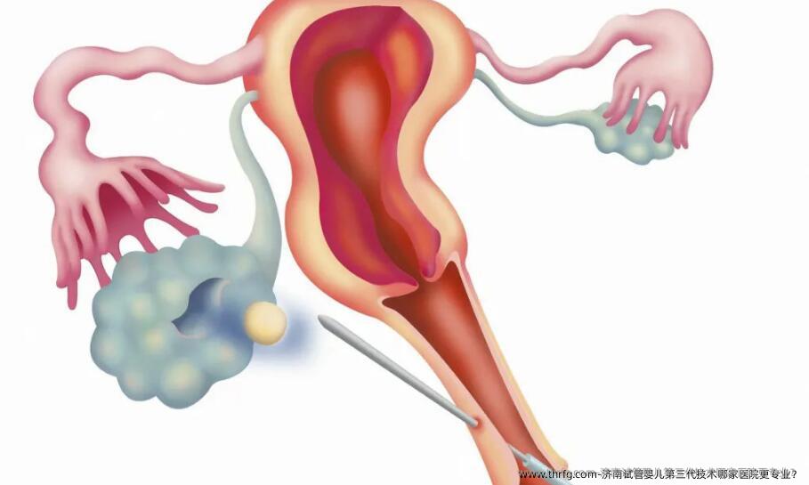 济南试管婴儿第三代技术哪家医院更专业？