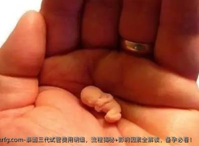 泰国三代试管费用明细，流程揭秘+影响因素全解读，备孕必看！