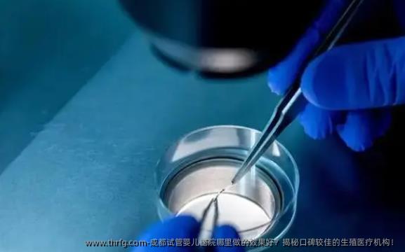 成都试管婴儿医院哪里做的效果好?揭秘口碑较佳的生殖医疗机构!