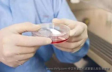 中卫市第三代试管婴儿在在哪里做