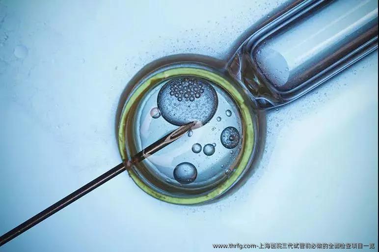 上海医院三代试管前必做的全面检查项目一览