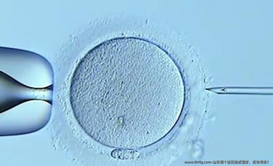 山东哪个医院做试管好,成功率高?