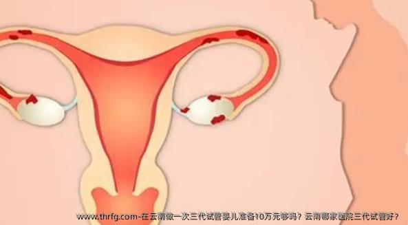 在云南做一次三代试管婴儿准备10万元够吗？云南哪家医院三代试管好？