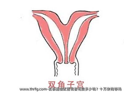 去泰国做试管需要花费多少钱？十万块钱够吗