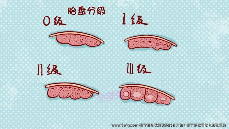 南宁最新试管医院排名介绍？南宁做试管婴儿去哪里好