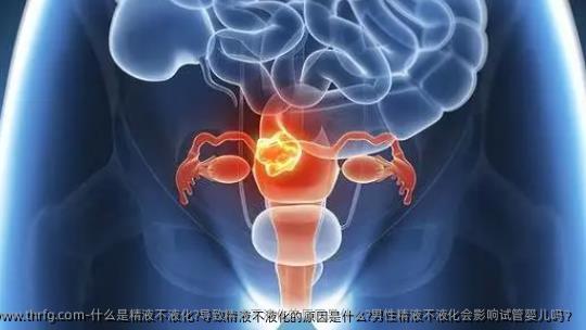 什么是精液不液化?导致精液不液化的原因是什么?男性精液不液化会影响试管婴儿吗？