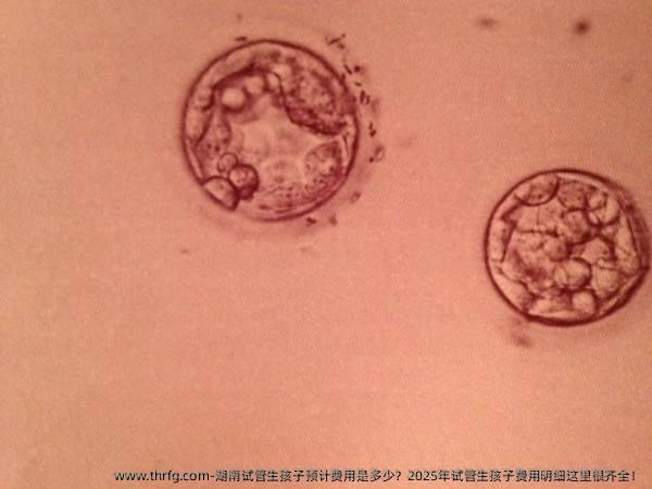 湖南试管生孩子预计费用是多少？2025年试管生孩子费用明细这里很齐全！