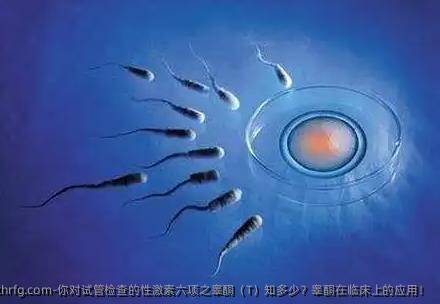 你对试管检查的性激素六项之睾酮（T）知多少？睾酮在临床上的应用！