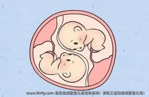 黄石做试管婴儿成功率高吗！黄石三医院做试管婴儿吗！