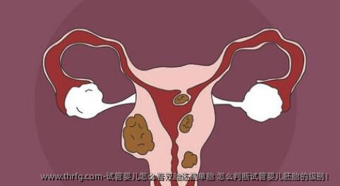 试管婴儿怎么看双胎还是单胎 怎么判断试管婴儿胚胎的级别！
