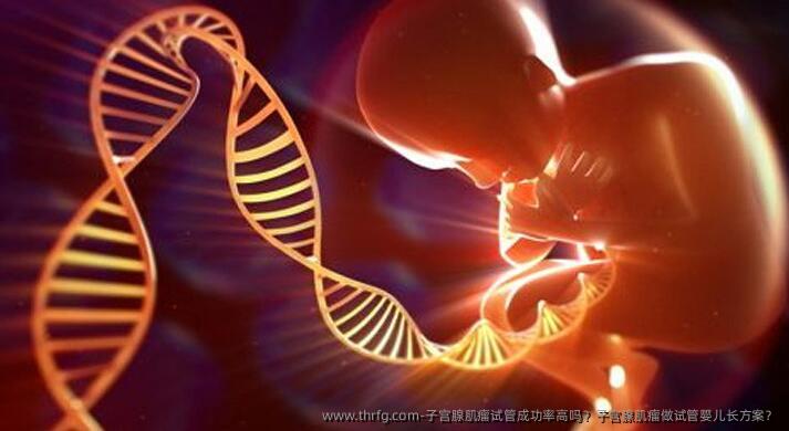 子宫腺肌瘤试管成功率高吗？子宫腺肌瘤做试管婴儿长方案？