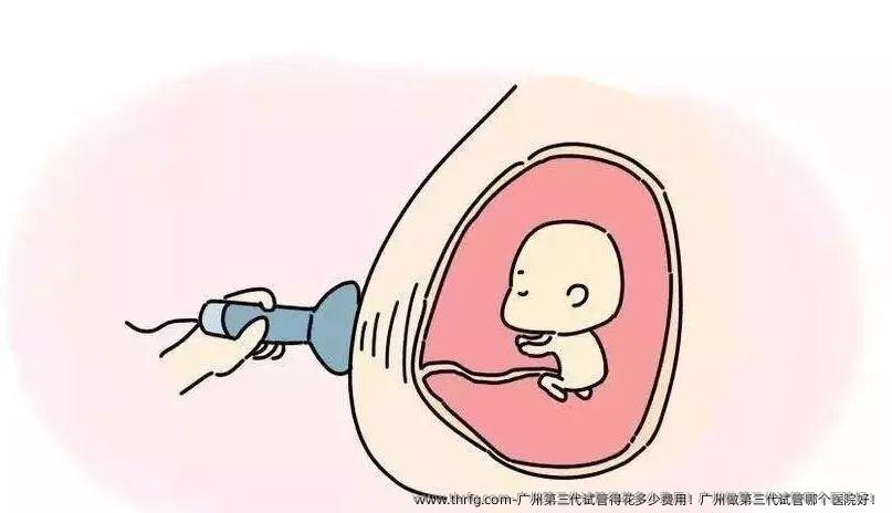 广州第三代试管得花多少费用！广州做第三代试管哪个医院好！