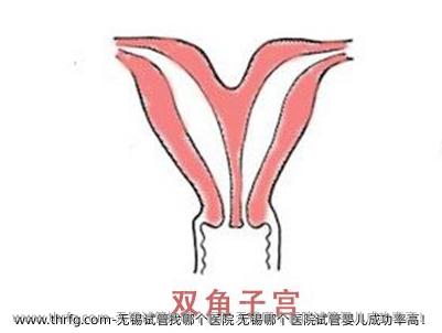 无锡试管找哪个医院 无锡哪个医院试管婴儿成功率高！