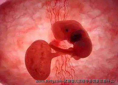 试管婴儿流程中各需要注意什么?