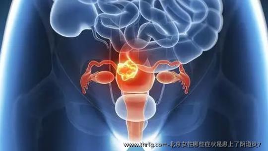 北京女性哪些症状是患上了阴道炎？