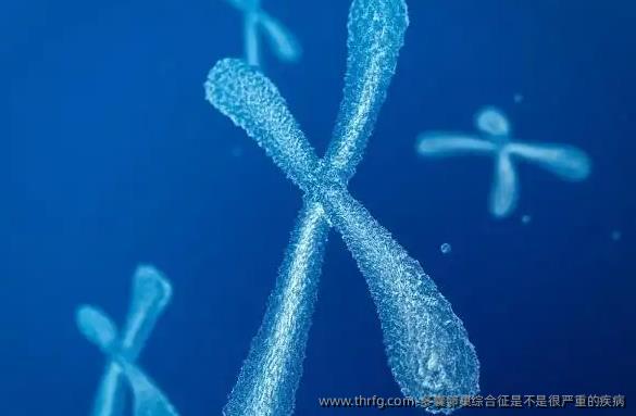 多囊卵巢综合征是不是很严重的疾病