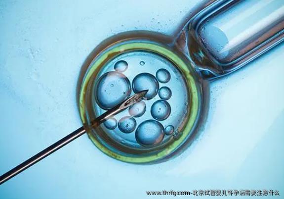 北京试管婴儿怀孕后需要注意什么