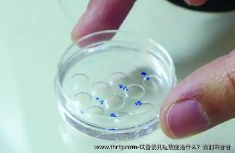 试管婴儿适应症是什么？我们来看看