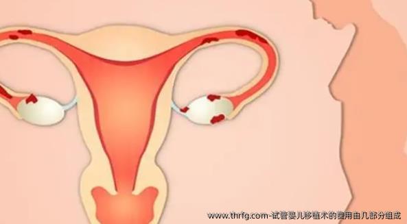 试管婴儿移植术的费用由几部分组成