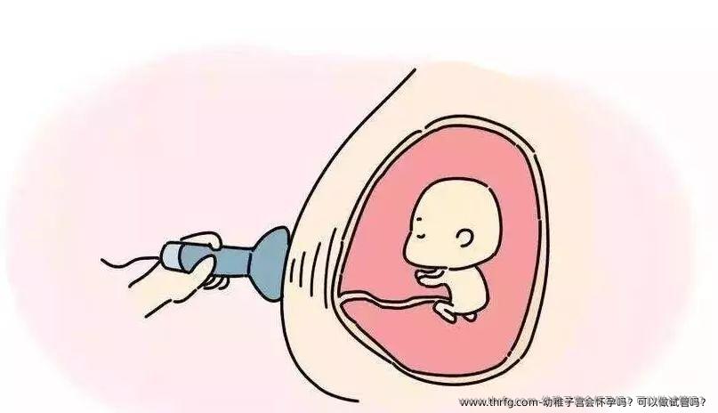 幼稚子宫会怀孕吗？可以做试管吗？