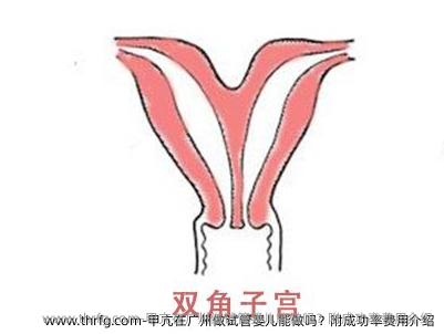 甲亢在广州做试管婴儿能做吗？附成功率费用介绍