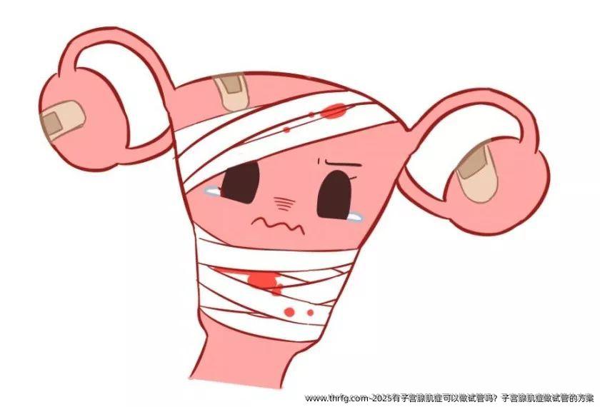 2025有子宫腺肌症可以做试管吗？子宫腺肌症做试管的方案