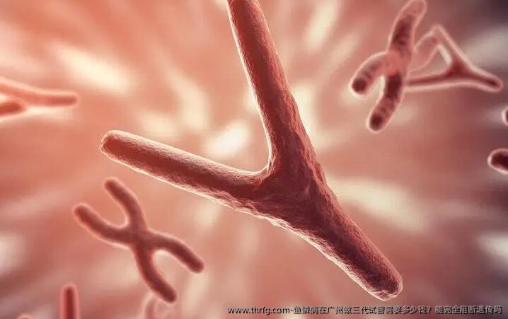 鱼鳞病在广州做三代试管需要多少钱?能完全阻断遗传吗