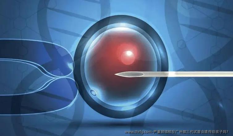 严重肺结核在广州做三代试管会遗传给孩子吗？
