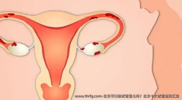 北京可以做试管婴儿吗？北京十大试管医院汇总