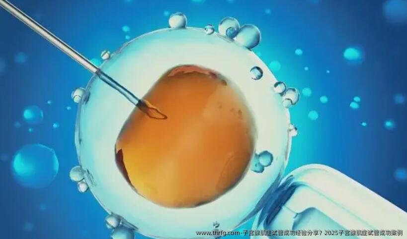 子宫腺肌症试管成功经验分享？2025子宫腺肌症试管成功案例