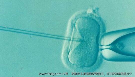 少精、无精症去泰国做试管婴儿，ICSI成功率有多少？