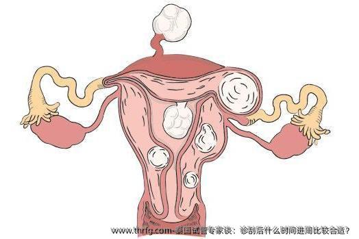 泰国试管专家谈：诊刮后什么时间进周比较合适？