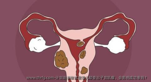 计划赴泰做试管婴儿却查出子宫肌瘤，会影响成功率吗？