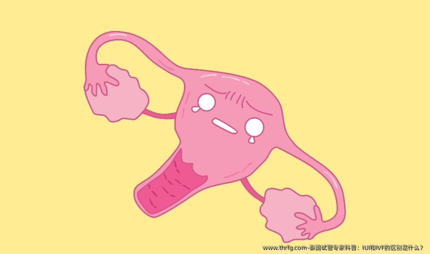 泰国试管专家科普：IUI和IVF的区别是什么？