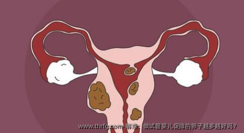 解惑：做试管婴儿促排的卵子越多越好吗？