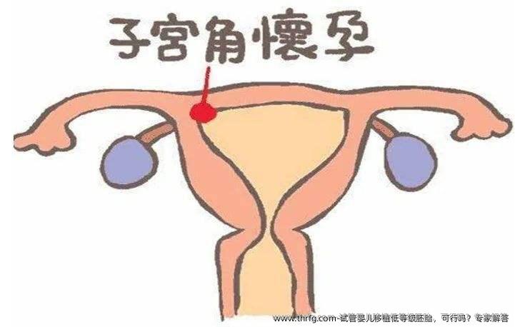 试管婴儿移植低等级胚胎，可行吗？专家解答