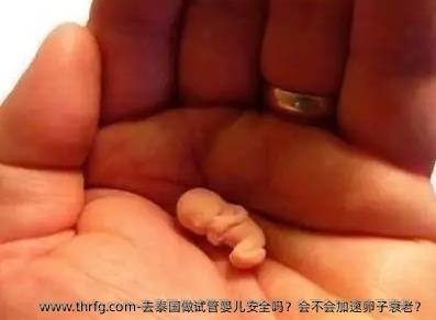 去泰国做试管婴儿安全吗？会不会加速卵子衰老？